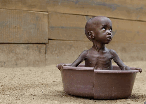 Starving child in Somalia (2011)